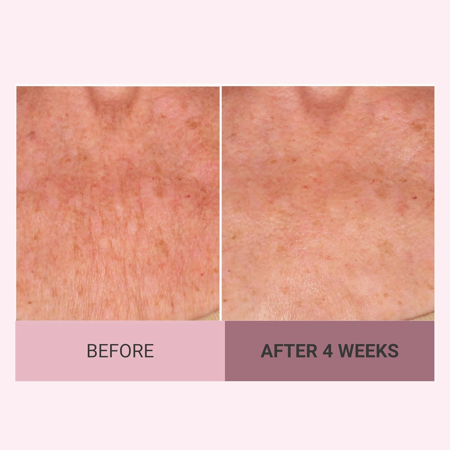 Consult Beaute Champagne Lift Hydrating Firming Body Cream with Pink Pepperslim for Crepey Skin Moisturizer Tightens, Tones & Hydrates Dry Skin on Arms & Legs - 8 oz.