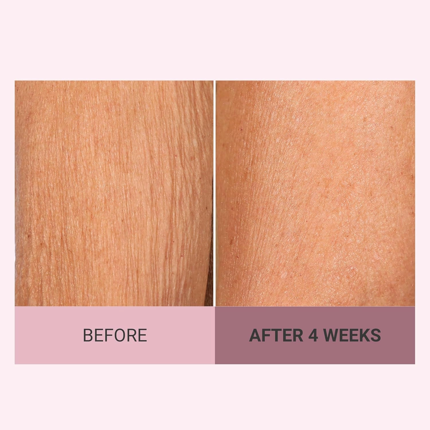 Consult Beaute Champagne Lift Hydrating Firming Body Cream with Pink Pepperslim for Crepey Skin Moisturizer Tightens, Tones & Hydrates Dry Skin on Arms & Legs - 8 oz.