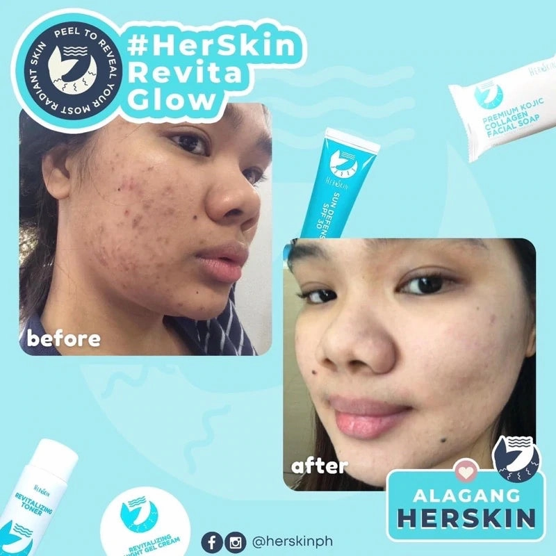 HerSkin Revita Glow Skin Rescue Set