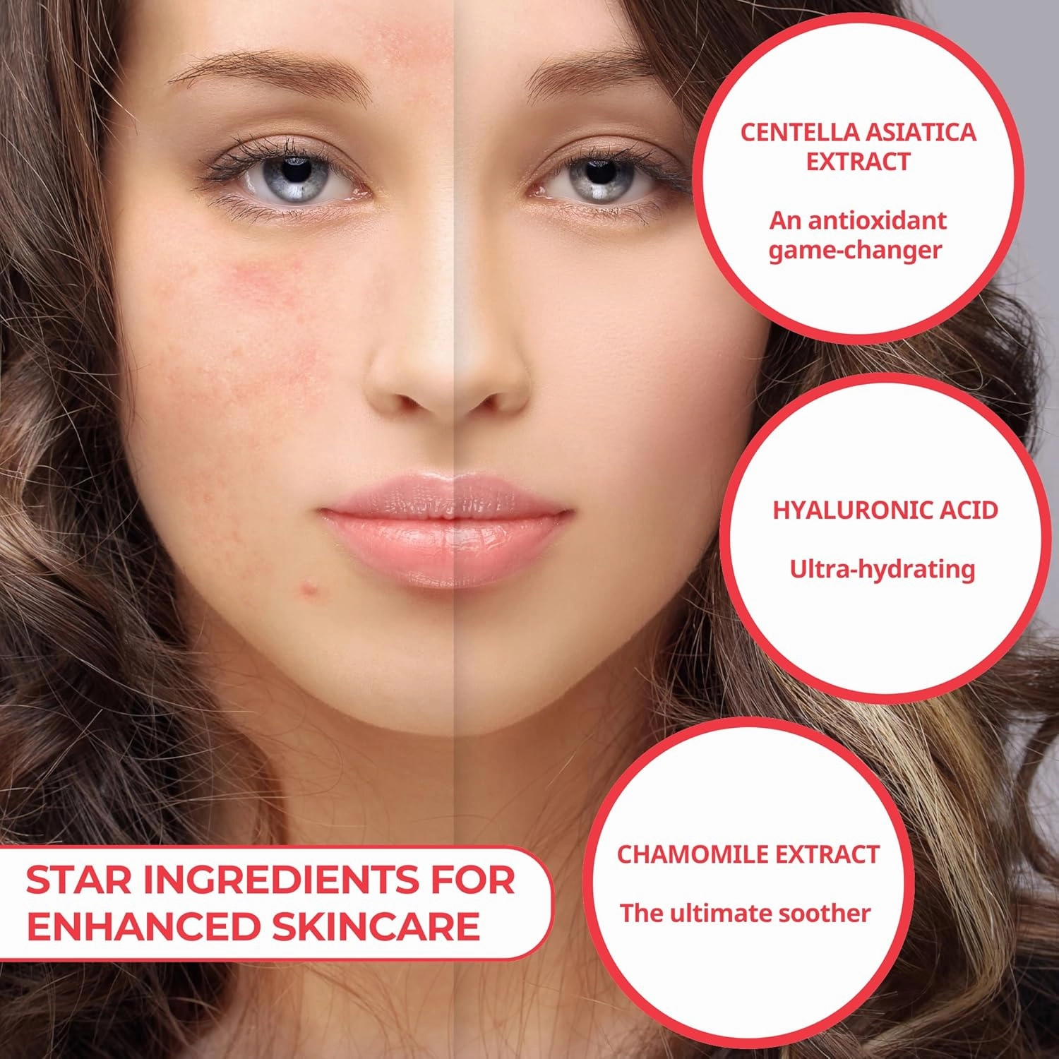 The Anti Redness Patch (2 Pack) | Bespoke Formula Pimple Patches for Face | Gentle on Skin, Tough on Redness |Results After 6 Hours | Strategically Curated Ingredients | Created By Dermatologists