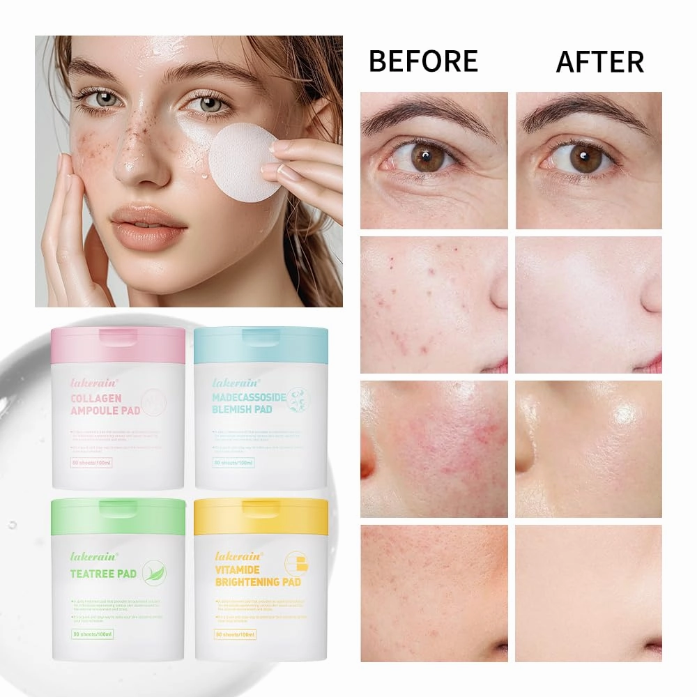 Toner Pads with Salicylic Acid | Deep Hydration Cotton Pads | Soothing After-Sun Redness Repair | Anti-Acne Wet Compress | Refreshing Toner Application 80Pads(Pink)